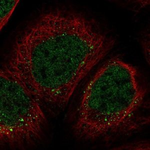 Anti-ZNF213 antibody produced in rabbit 
