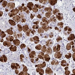 Anti-ZNF214 antibody produced in rabbit 