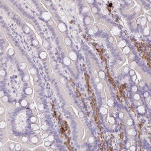 Anti-ZNF215 antibody produced in rabbit 