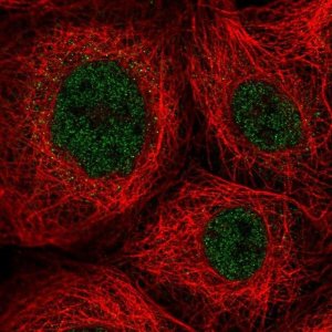 Anti-ZNF22 antibody produced in rabbit 