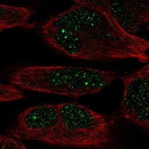 Anti-ZNF221 antibody produced in rabbit 