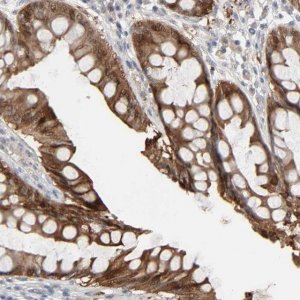 Anti-ZNF222 antibody produced in rabbit HPA004086-100UL