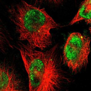 Anti-ZNF222 antibody produced in rabbit HPA004086-100UL