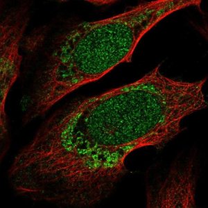 Anti-ZNF223 antibody produced in rabbit 