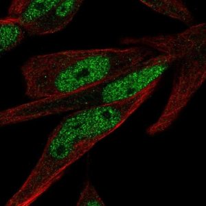 Anti-ZNF225 antibody produced in rabbit 
