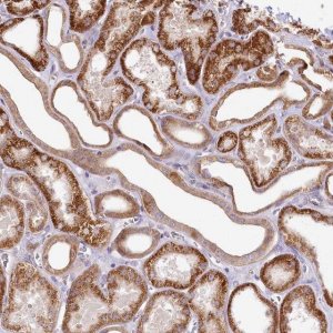 Anti-ZNF226 antibody produced in rabbit 