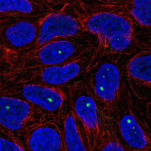Anti-ZNF226 antibody produced in rabbit 