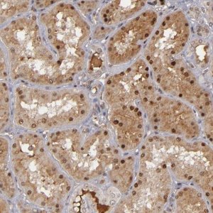 Anti-ZNF234 antibody produced in rabbit 
