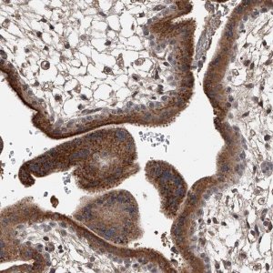 Anti-ZNF25 antibody produced in rabbit 