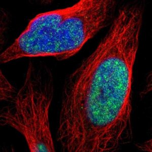 Anti-ZNF250 antibody produced in rabbit 