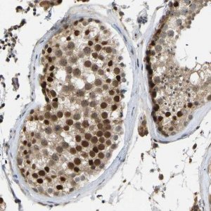 Anti-ZNF251 antibody produced in rabbit 
