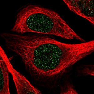 Anti-ZNF256 antibody produced in rabbit 