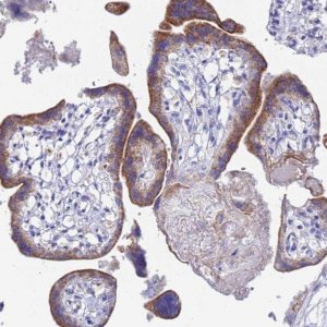 Anti-ZNF26 antibody produced in rabbit 