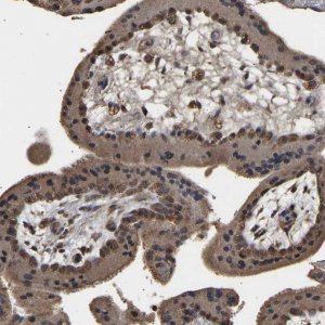 Anti-ZNF26 antibody produced in rabbit HPA018329-100UL