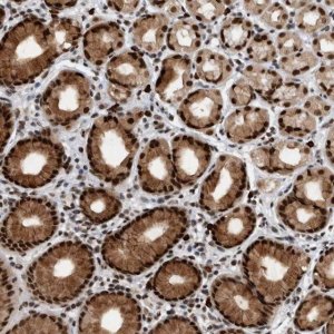 Anti-ZNF260 antibody produced in rabbit 