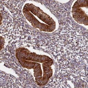 Anti-ZNF268 antibody produced in rabbit 
