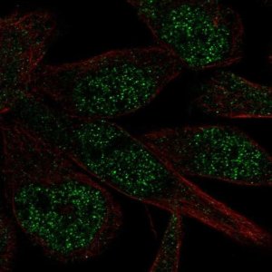 Anti-ZNF273 antibody produced in rabbit 