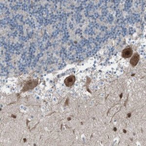 Anti-ZNF276 antibody produced in rabbit 