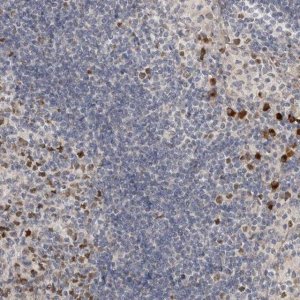 Anti-ZNF277 antibody produced in rabbit 