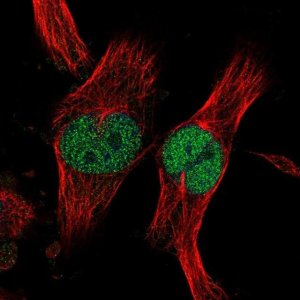 Anti-ZNF277 antibody produced in rabbit 