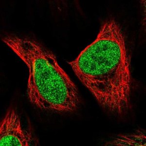 Anti-ZNF280B antibody produced in rabbit 