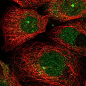 Anti-ZNF280D antibody produced in rabbit 