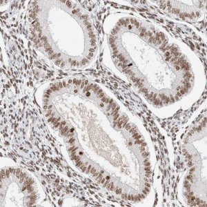 Anti-ZNF282 antibody produced in rabbit 