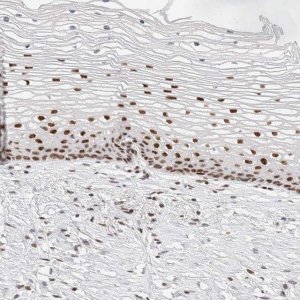 Anti-ZNF282 antibody produced in rabbit 
