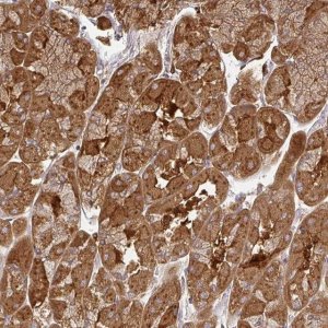 Anti-ZNF285 antibody produced in rabbit 