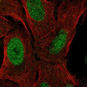 Anti-ZNF296 antibody produced in rabbit 