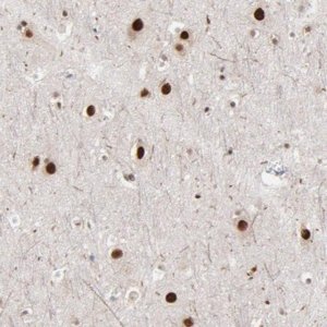 Anti-ZNF3 antibody produced in rabbit 