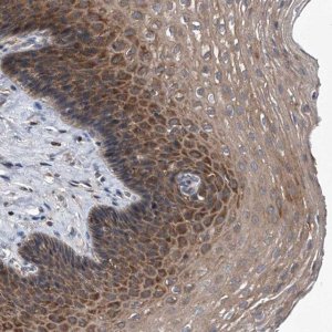 Anti-ZNF30 antibody produced in rabbit 