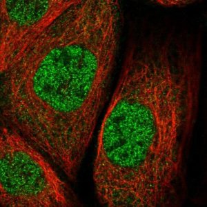 Anti-ZNF30 antibody produced in rabbit 