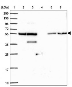 Anti-ZNF300 antibody produced in rabbit HPA051777-100UL