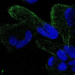 Anti-ZNF302 antibody produced in rabbit 