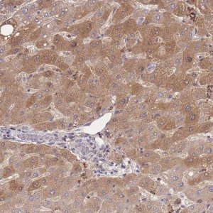 Anti-ZNF304 antibody produced in rabbit 