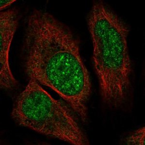 Anti-ZNF304 antibody produced in rabbit 