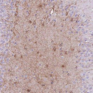 Anti-ZNF311 antibody produced in rabbit 