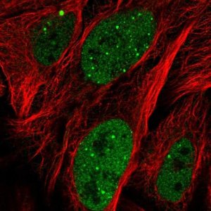 Anti-ZNF32 antibody produced in rabbit 