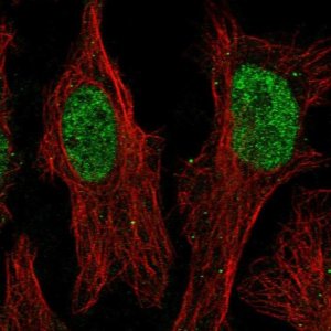 Anti-ZNF320 antibody produced in rabbit 