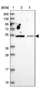 Anti-ZNF322 antibody produced in rabbit 