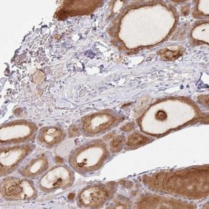 Anti-ZNF33A antibody produced in rabbit 