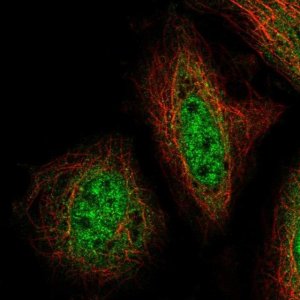 Anti-ZNF34 antibody produced in rabbit 