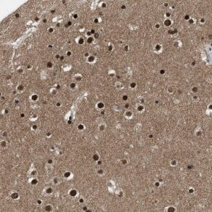 Anti-ZNF346 antibody produced in rabbit 