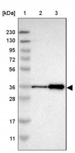Anti-ZNF346 antibody produced in rabbit 