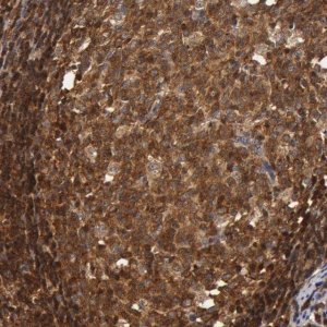 Anti-ZNF350 antibody produced in rabbit HPA001521-100UL