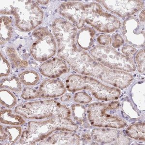 Anti-ZNF354A antibody produced in rabbit 