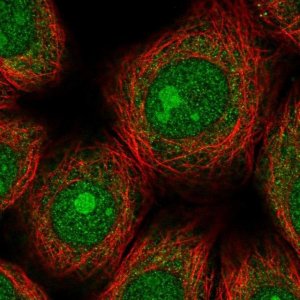 Anti-ZNF354A antibody produced in rabbit 