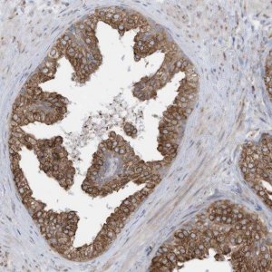 Anti-ZNF354C antibody produced in rabbit 