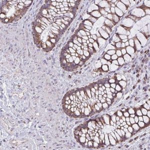 Anti-ZNF362 antibody produced in rabbit 